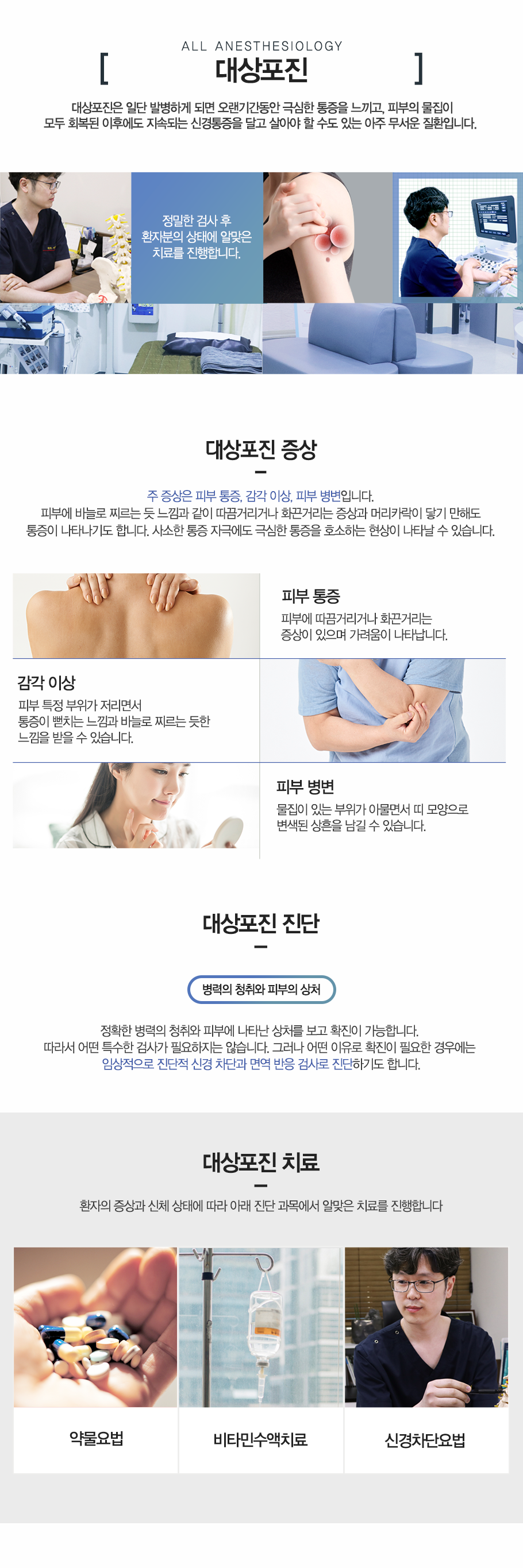 대상포진