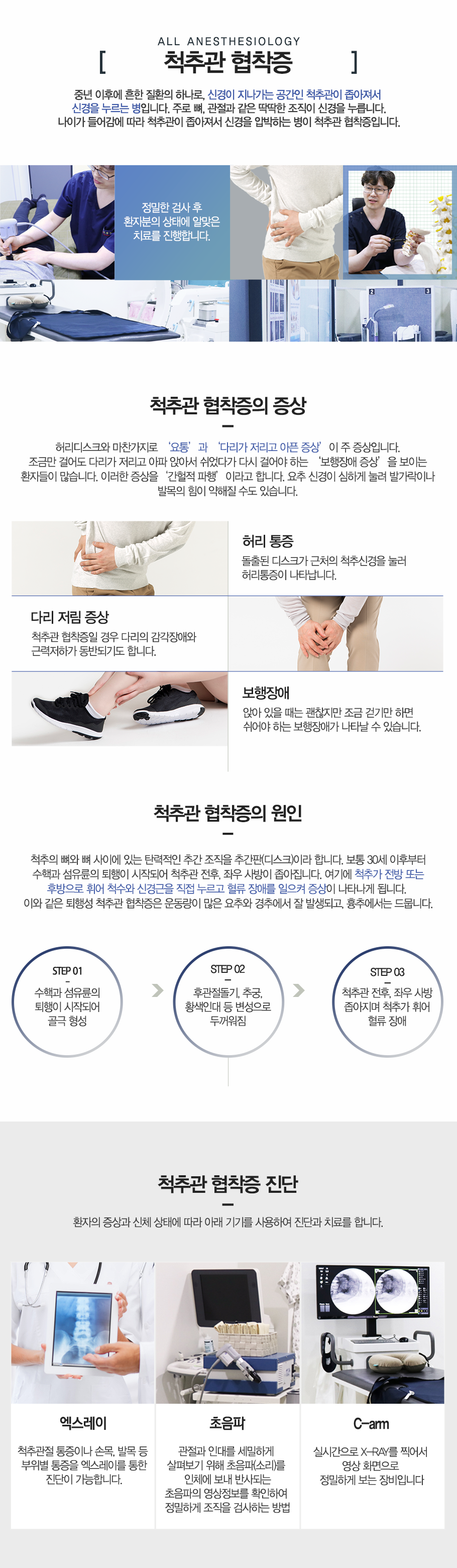 척추관협착증