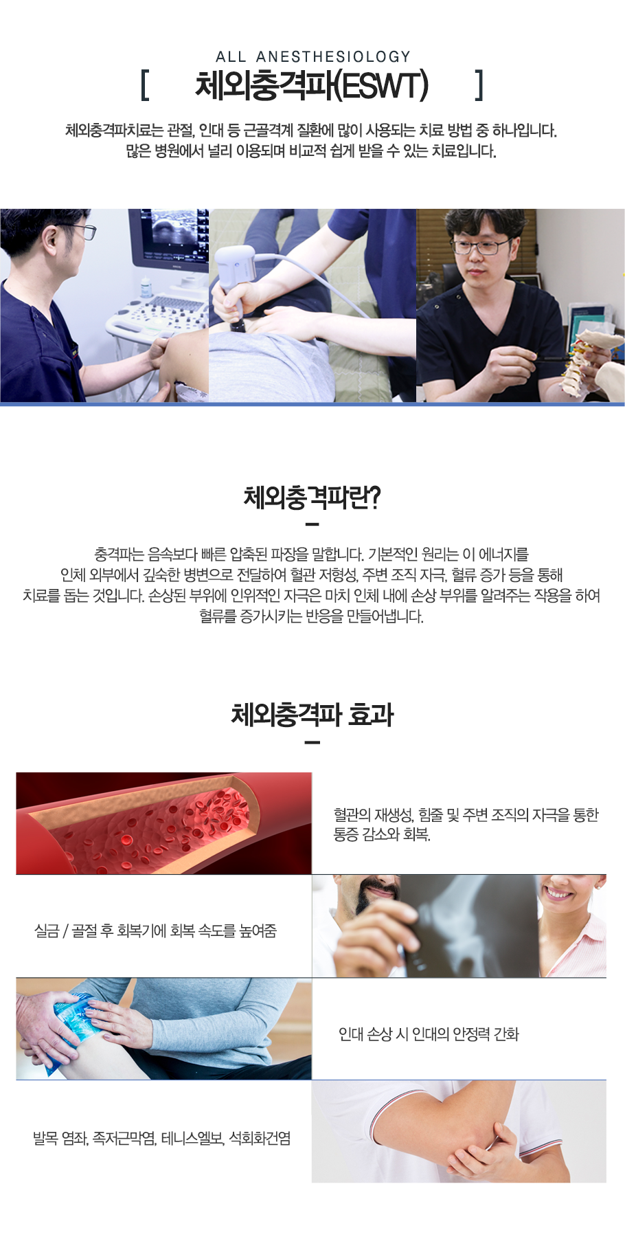 체외충격파