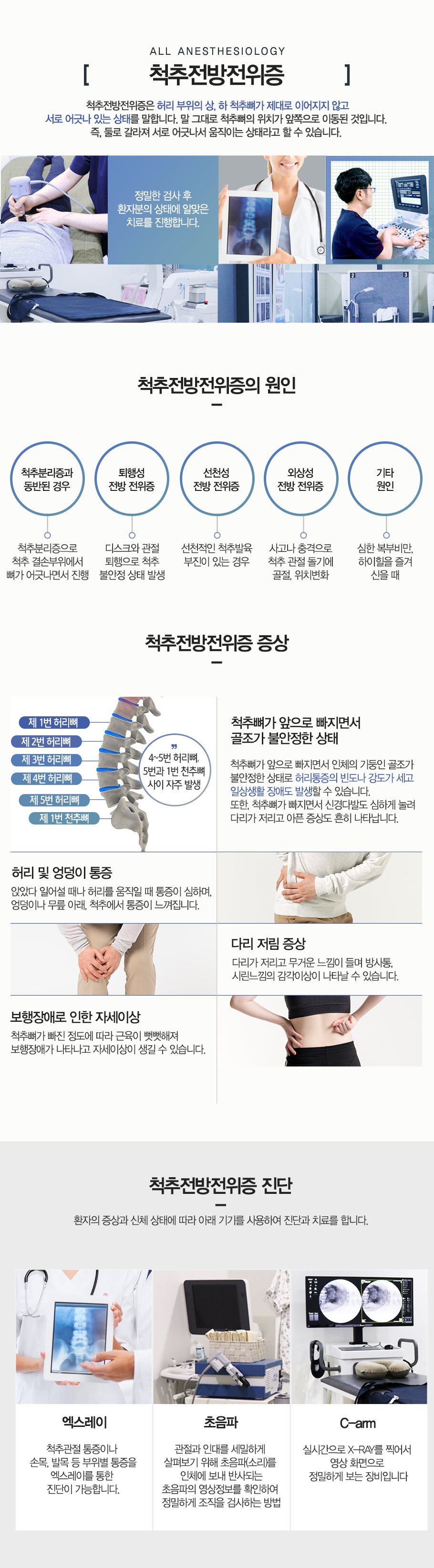 척추전방전위증